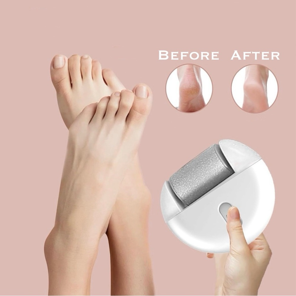 Electric Callus Remover - Picture 3 of 11